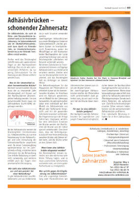 Die Voll- oder Totalprothese