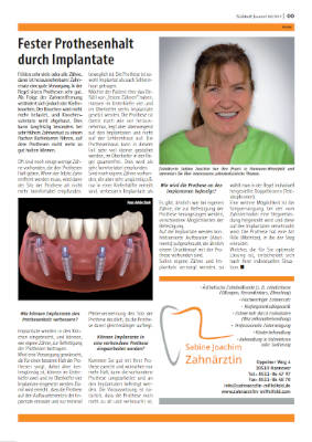 Fester-Prothesenhalt-durch-Implantate